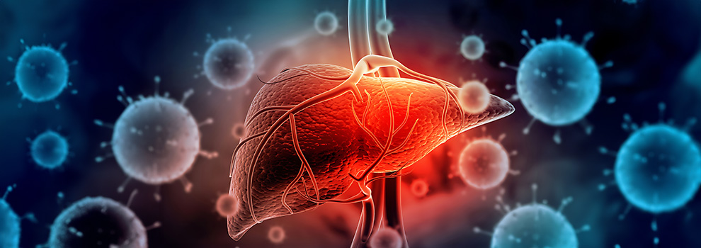 Cirrhosis